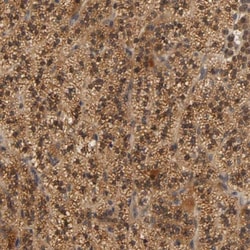 SCAP Antibody, Novus Biologicals 0.1 mL | Buy Online | Novus Biologicals | Fisher Scientific